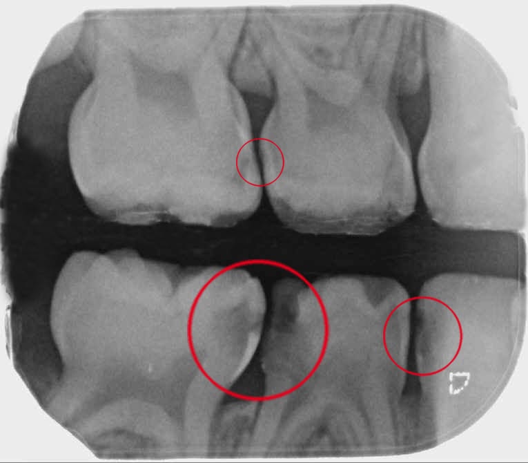 Tratamento dentário